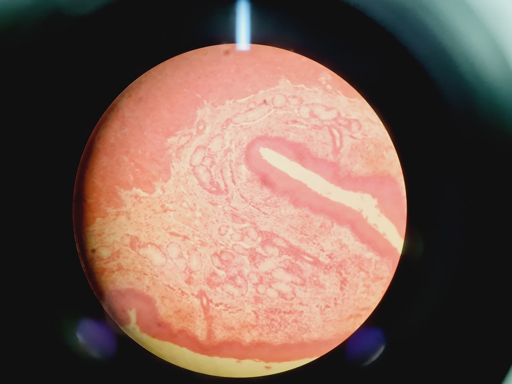 Image of Leica DMIRB Inverted Microscope w/ 4 x Objectives 4x/10x/40x C Plan Lab