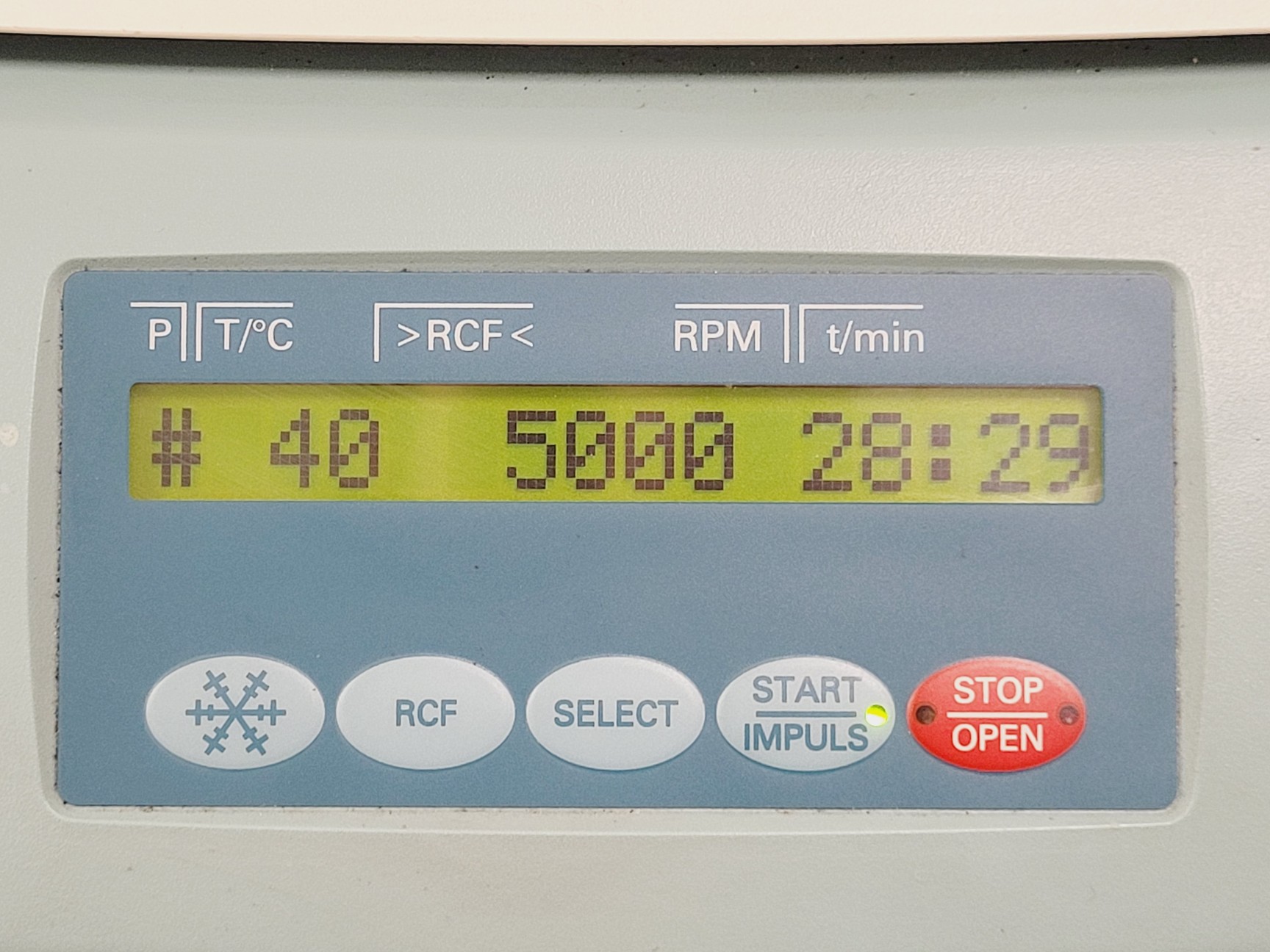 Image of Hettich Universal 320R Benchtop Centrifuge