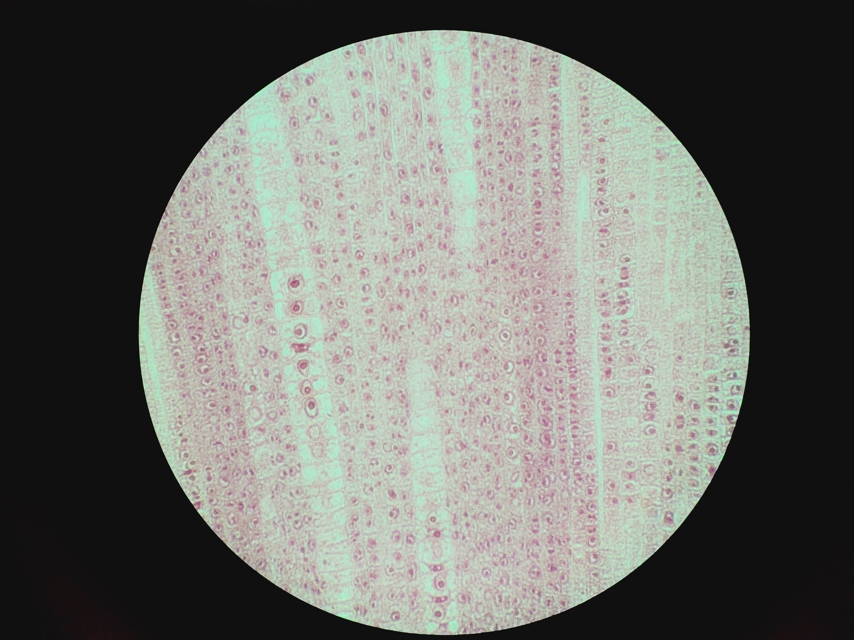 Image of Olympus BX43F Compound Microscope w/ 4 x Objectives 2x/10x/20x/40x PlanC PlanN