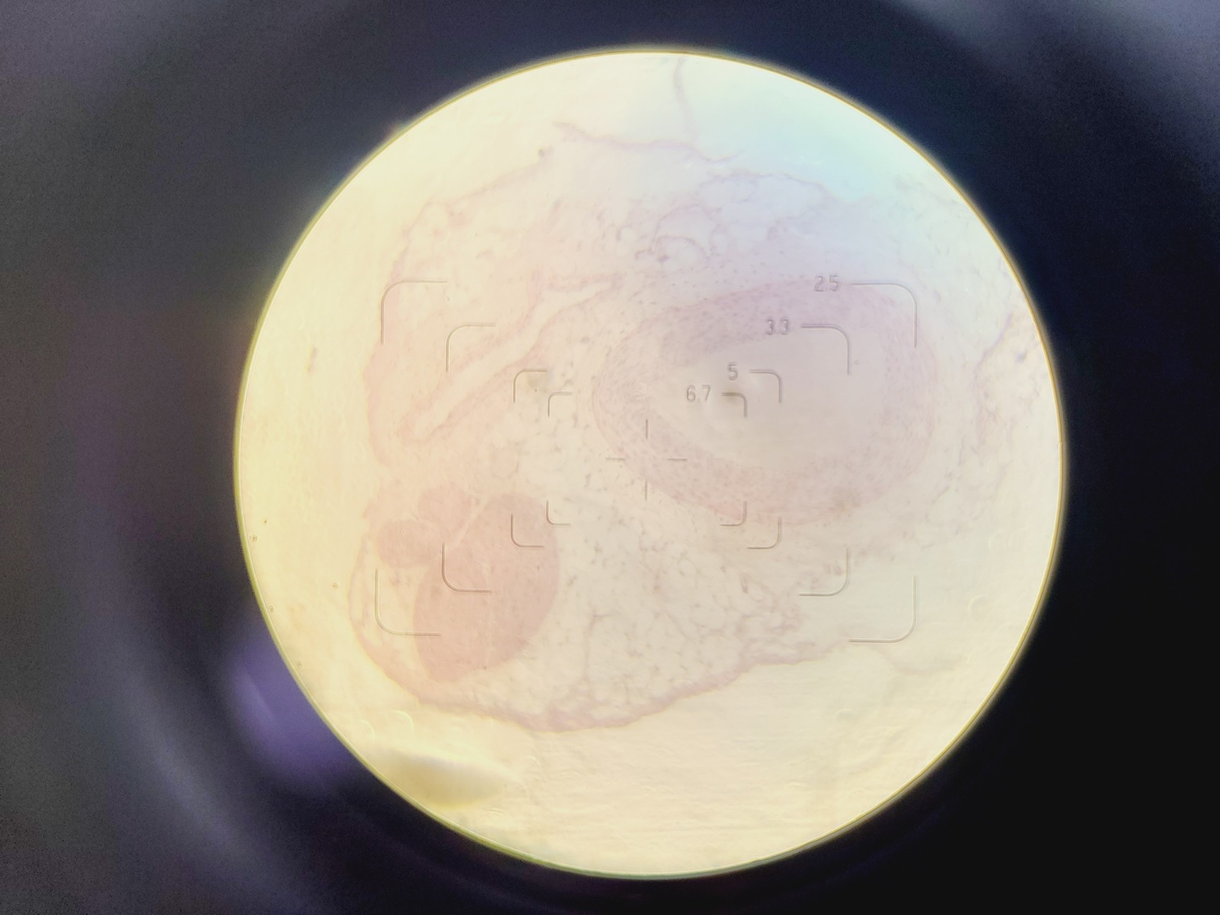 Image of Olympus CK Inverted Microscope w/ Olympus OM 2 Camera & Mount 