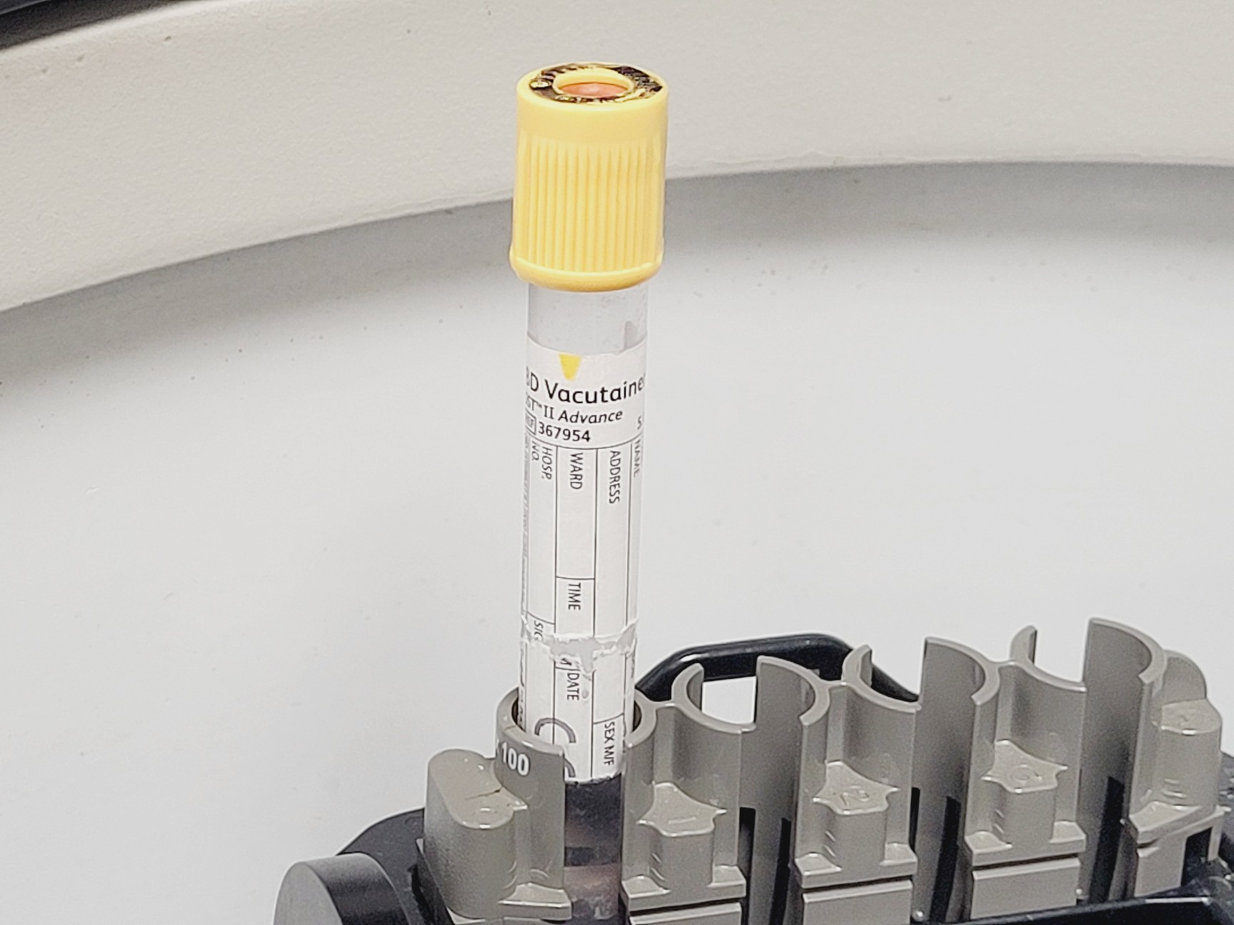 Image of Beckman Coulter Spinchron DLX Benchtop Centrifuge