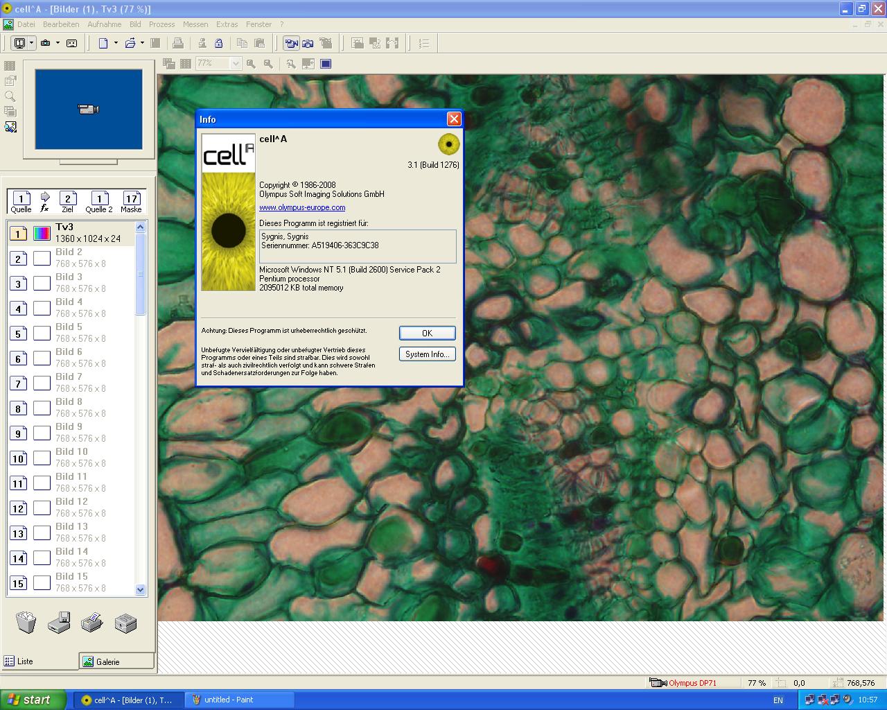 Image of Olympus IX81 with Olympus MT20 Cell IR System