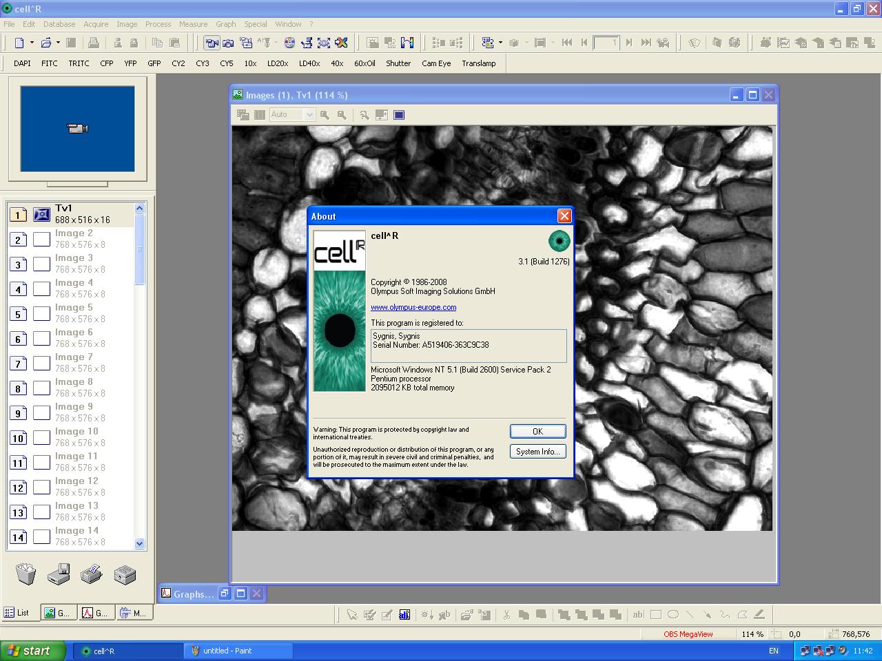 Image of Olympus IX81 with Olympus MT20 Cell IR System