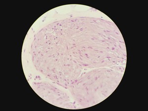 Thumbnail image of Leica DM IRB Inverted Microscope, Incubation Chamber, EBQ 100 & Hot Air Blower