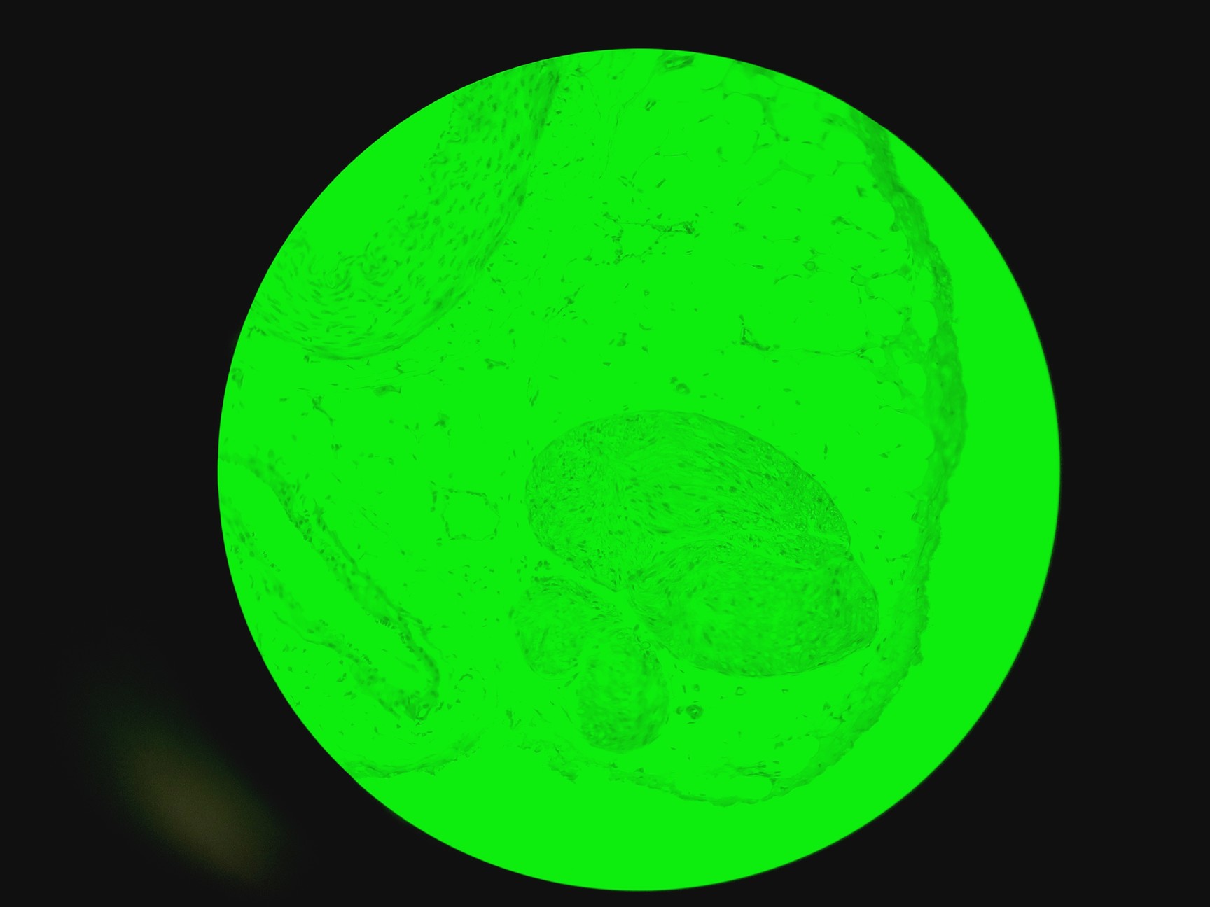 Image of Leica DM IRB Inverted Microscope, Incubation Chamber, EBQ 100 & Hot Air Blower