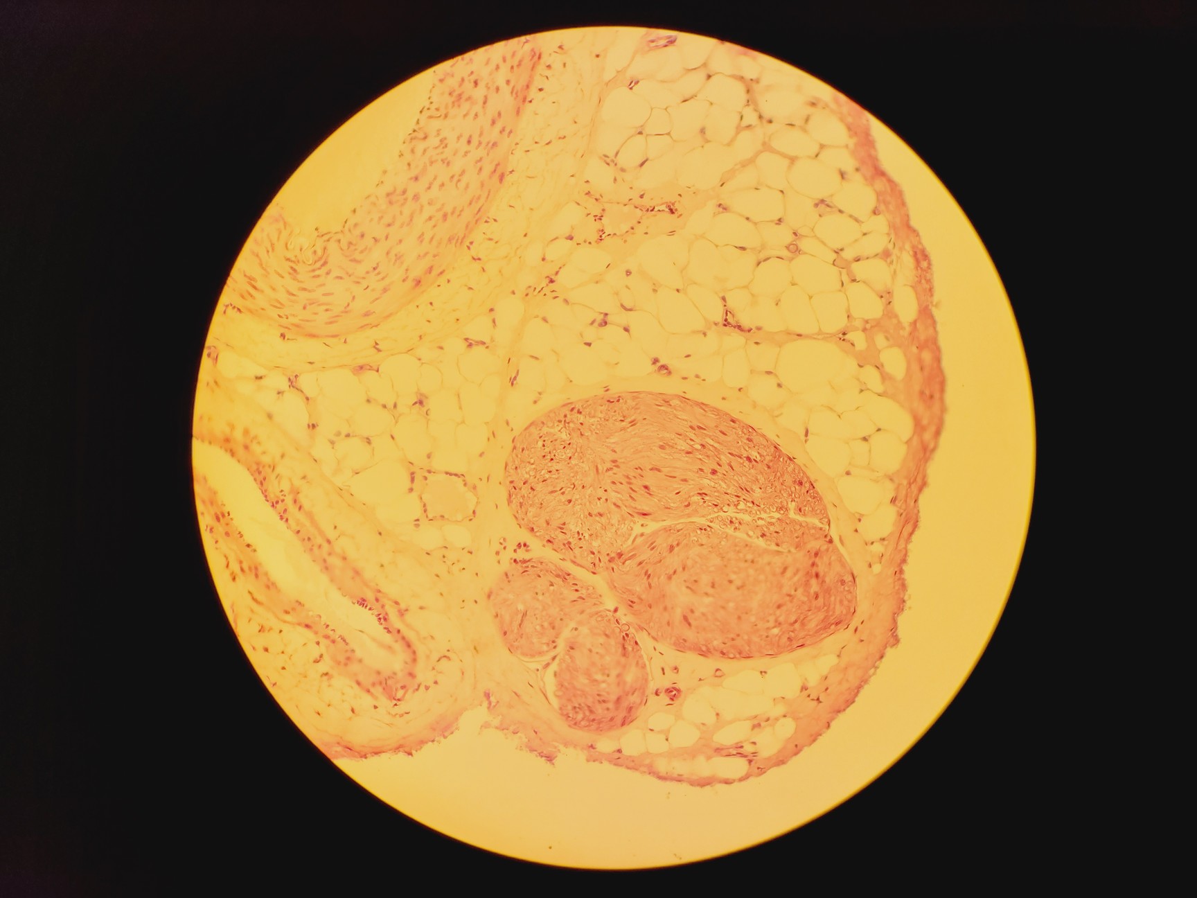 Image of Leica DM IRB Inverted Microscope, Incubation Chamber, EBQ 100 & Hot Air Blower