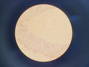 Thumbnail image of Leica DMIL 090-131-00.1 Microscope w/ 3 Objectives