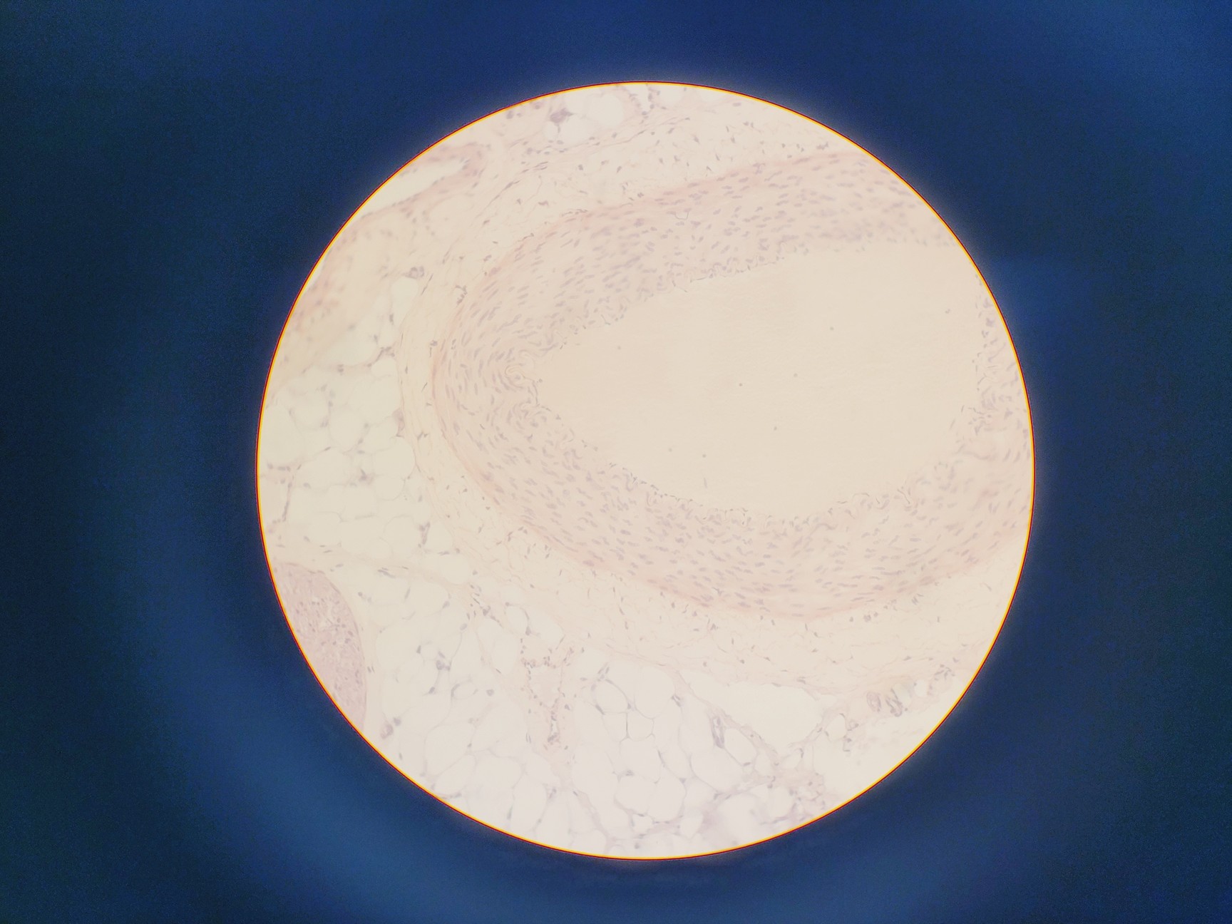 Image of Leica DMIL 090-131-00.1 Microscope w/ 3 Objectives