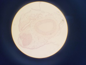 Thumbnail image of Leica DMIL 090-131-00.1 Microscope w/ 3 Objectives