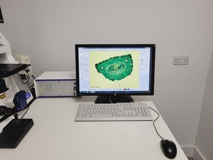 Thumbnail image of Zeiss PALM MicroBeam System with PC & Software