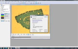 Thumbnail image of Zeiss PALM MicroBeam System with PC & Software