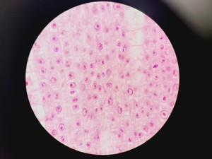 Thumbnail image of Olympus BX51 Microscope w. 2x pE-100 CoolLED Heads and Combiner