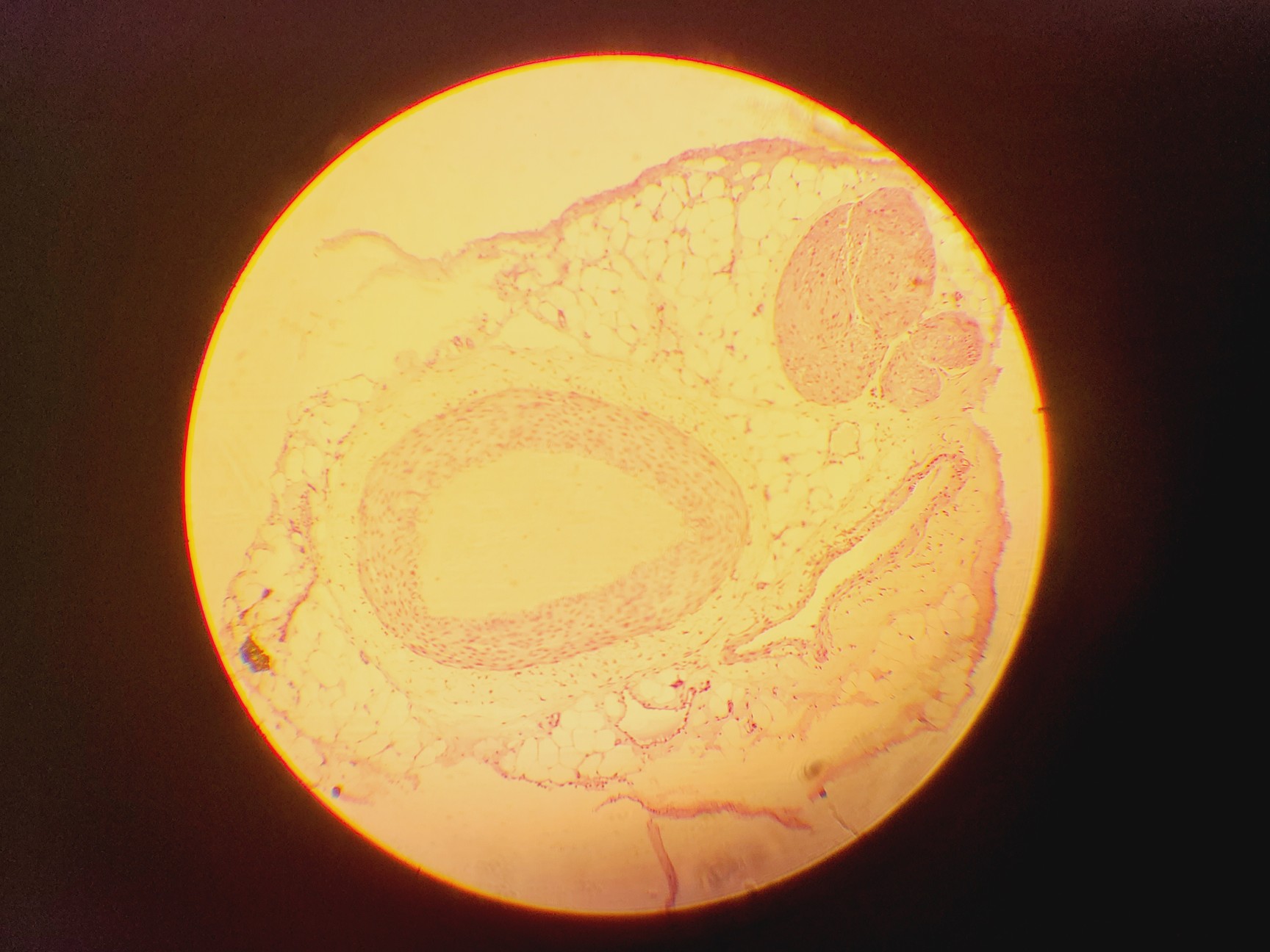 Image of Olympus CH Monocular Compound Microscope w/ 10x/40x/100x Lab