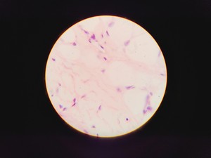 Thumbnail image of Olympus CH Compound Monocular Microscope w/ 3 x Objectives 10x/40x/100x 