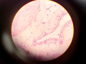 Thumbnail image of Olympus CH Compound Monocular Microscope w/ 3 x Objectives 10x/40x/100x 