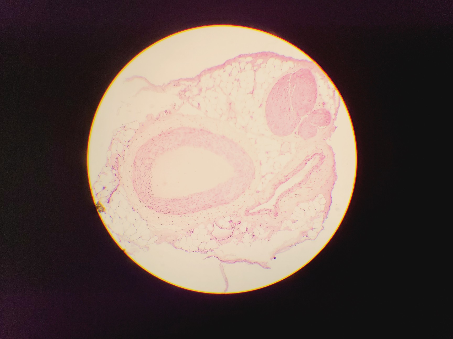 Image of Olympus CH Compound Monocular Microscope w/ 3 x Objectives 10x/40x/100x 