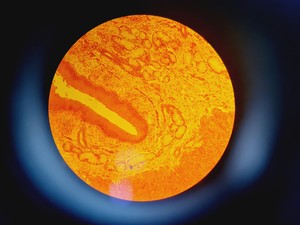 Thumbnail image of Leica DMR 020-525.028 Compound Microscope with 6 x Objectives