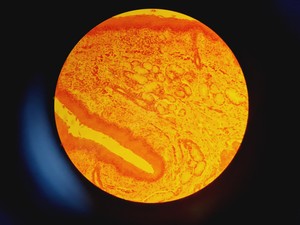 Thumbnail image of Leica DMR 020-525.028 Compound Microscope with 6 x Objectives