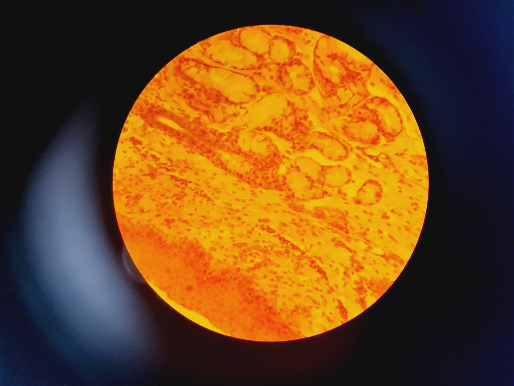 Image of Leica DMR 020-525.028 Compound Microscope with 6 x Objectives