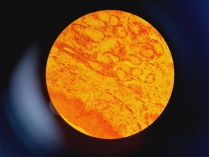 Thumbnail image of Leica DMR 020-525.028 Compound Microscope with 6 x Objectives