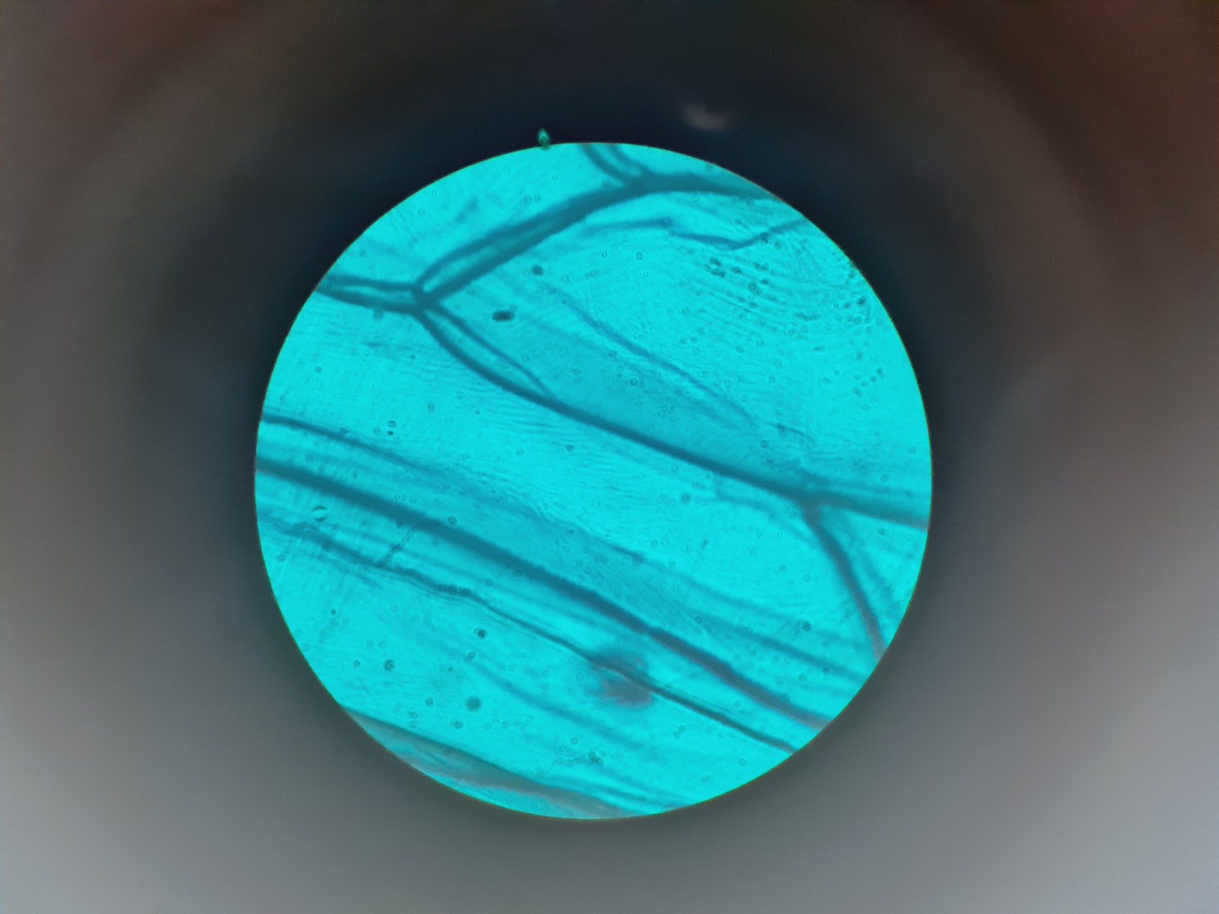 Image of Leitz Laborlux S Microscope 020-505.030 with 5 x Objectives