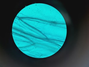 Thumbnail image of Carl Zeiss Axioskop 50 w/ HBO 50 & 4 x Objectives 10/16/40/100x NEOFLUAR