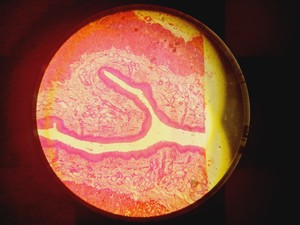 Thumbnail image of Olympus CKX53 Microscope with CoolLED pE-300 w/ 4 x Objectives 2/4/10/20x Lab