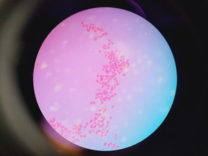 Thumbnail image of Olympus BX60M Upright Fluorescence Motorized Microscope