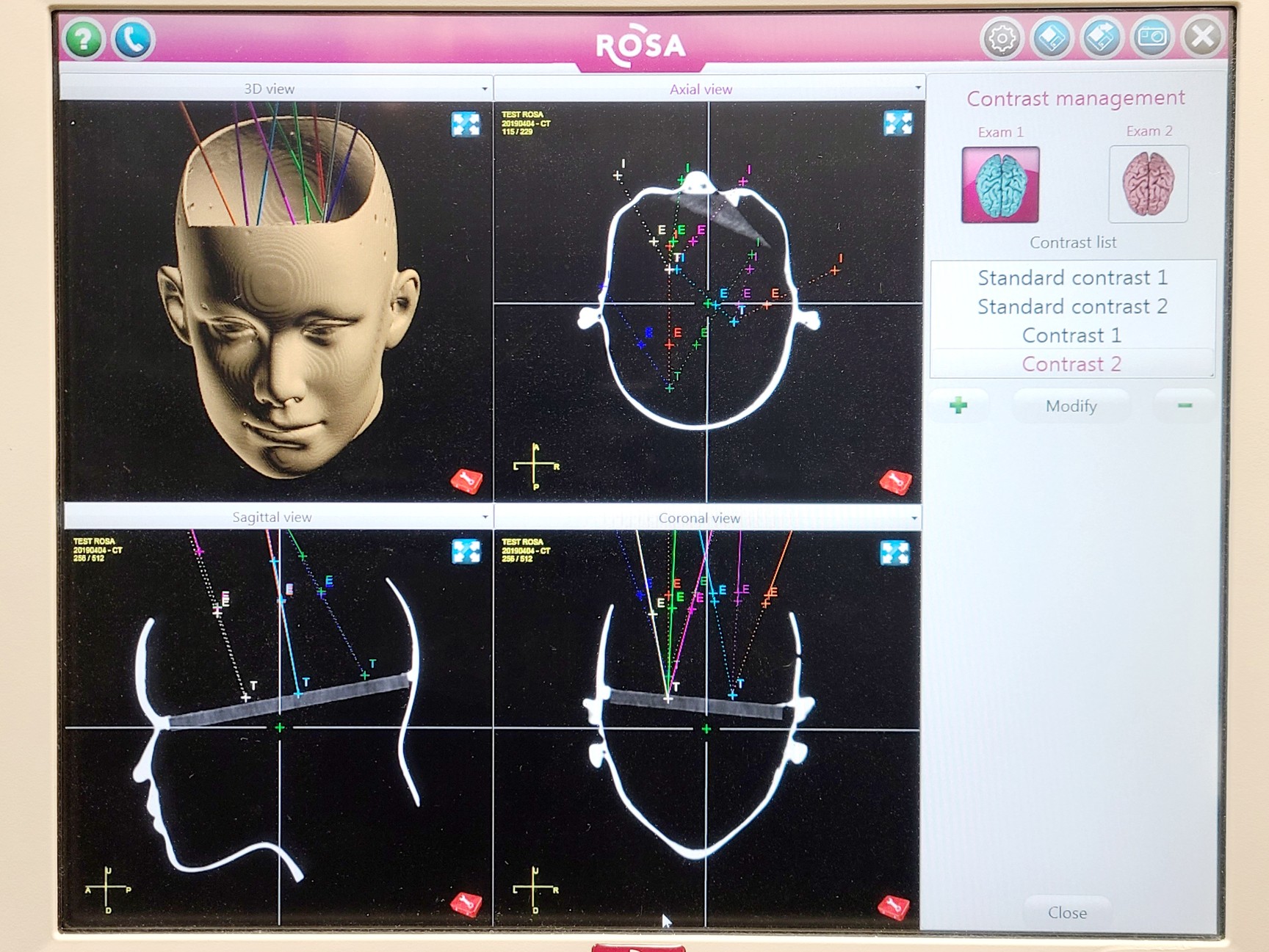 Image of Medtech ROSA Robotised Stereotactic Assistant 