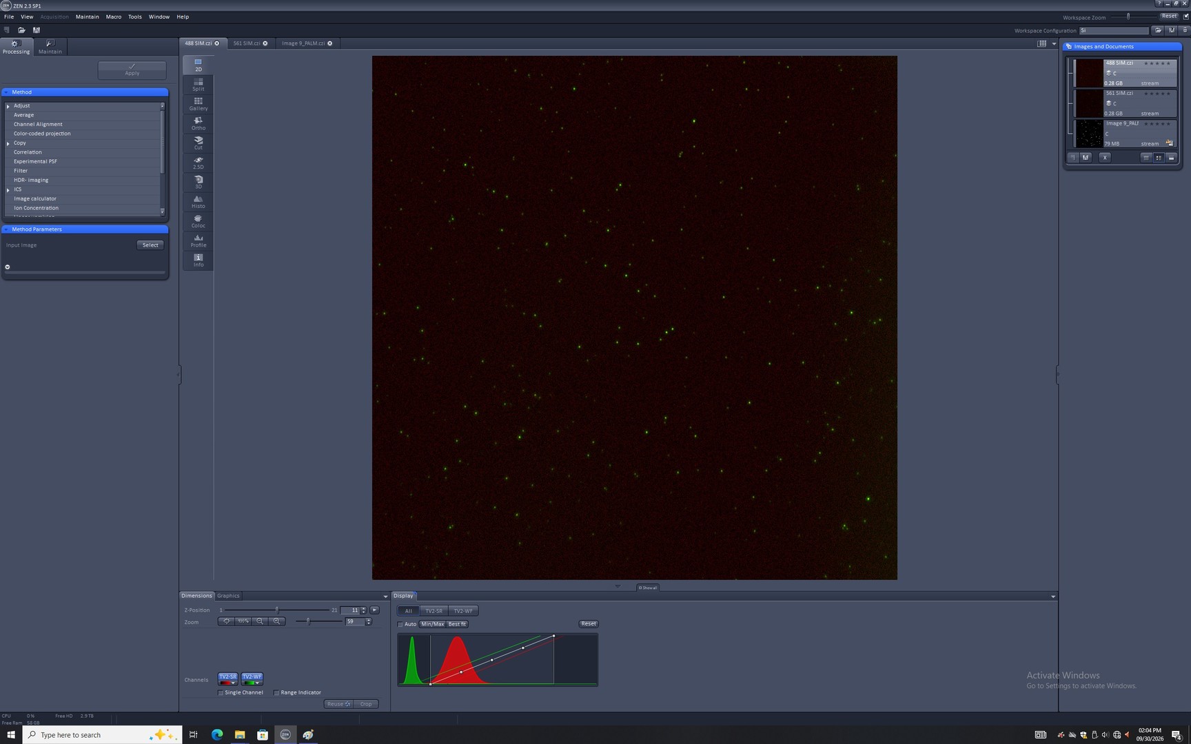 Image of Zeiss ELYRA PS.1 Confocal Microscope System w/ Observer.Z1, PC, Software & Optic