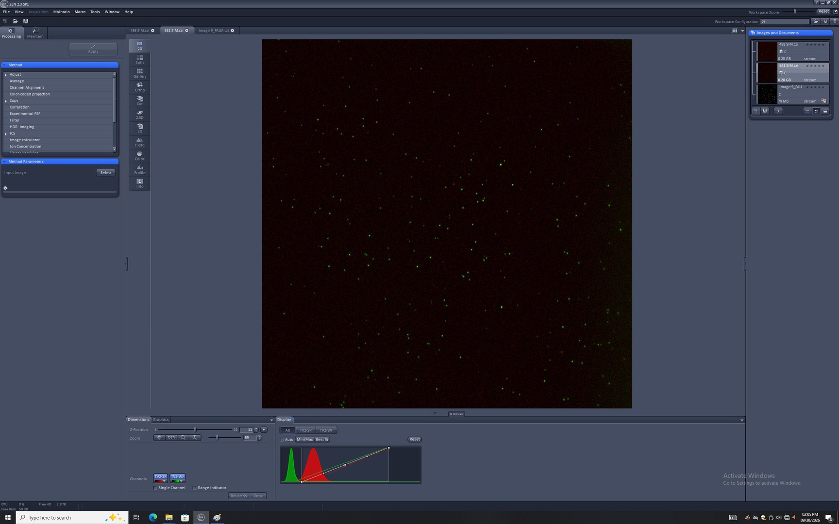 Image of Zeiss ELYRA PS.1 Confocal Microscope System w/ Observer.Z1, PC, Software & Optic