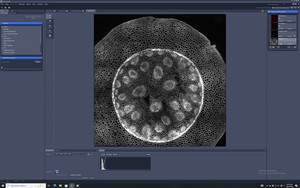 Thumbnail image of Zeiss ELYRA PS.1 Confocal Microscope System w/ Observer.Z1, PC, Software & Optic