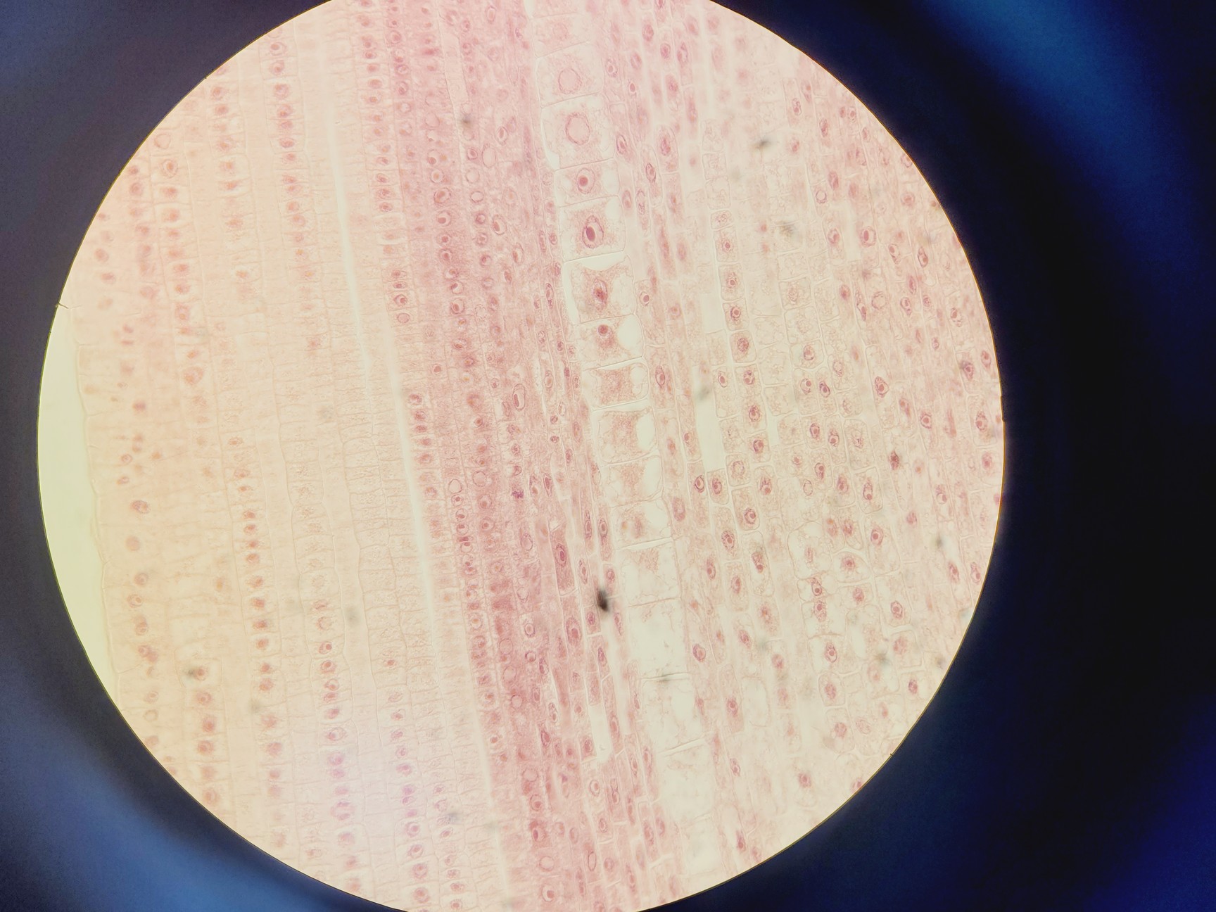 Image of Zeiss Axiophot Photomicroscope w/ HBO 100, G509159, 5 x Objectives 
