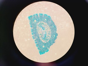 Thumbnail image of Nikon Eclipse Ti Confocal Microscope System Model TI-DH w/ Intenslight C-HGFI