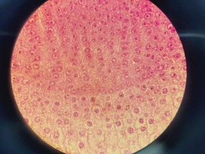 Thumbnail image of Carl Zeiss Axioplan Compound Microscope w/ 3 x Objectives 4x/10x/100x