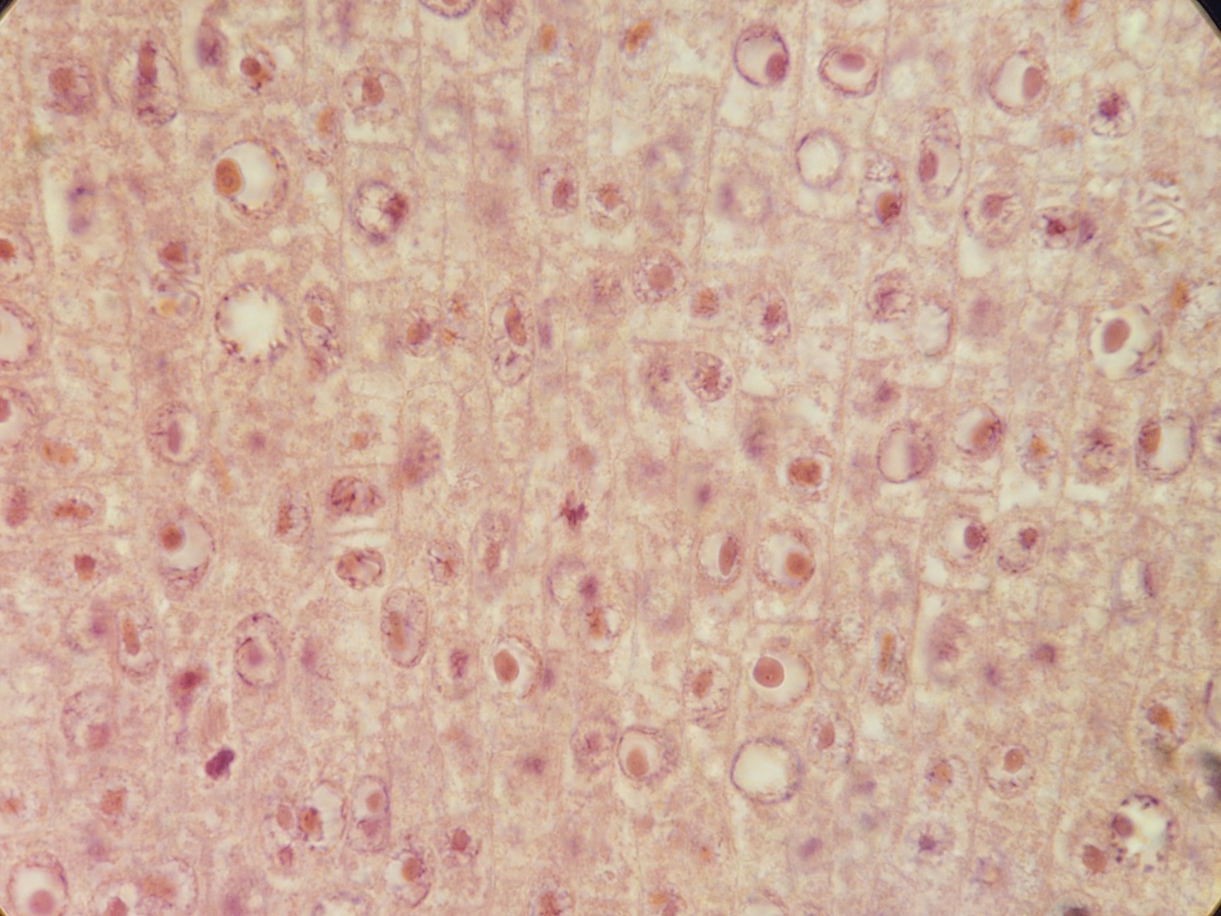 Image of Carl Zeiss Axiovert 10 Inverted Microscope w/ Plan-NEOFLUER 100X/1,30 Oil 44 40 