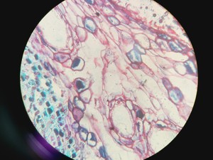 Thumbnail image of Leica Germany HCX PL APO 40x/1.25-0.75 OIL CS ∞/0.17/E Objective No. 506179