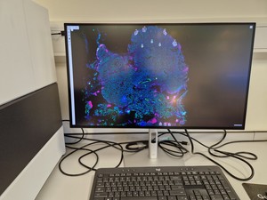 Thumbnail image of Bruker Spatial Biology GeoMx DSP Digital Spatial Profiler Lab
