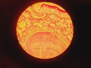 Thumbnail image of Zeiss Axioskop Microscope, 3 x Objectives (NEOFL 10x/40x/100x) EBQ 100 & PSU-100