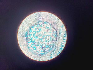 Thumbnail image of Olympus CHT CH-2 Compound Microscope W/ 0.10/0.25/0.65 Objectives