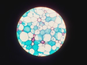 Thumbnail image of Olympus CHT CH-2 Compound Microscope W/ 0.10/0.25/0.65 Objectives