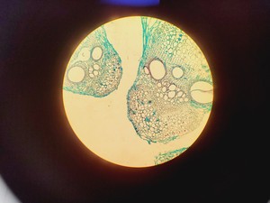 Thumbnail image of Olympus CHT CH-2 Compound Microscope W/ 0.10/0.25/0.65 Objectives