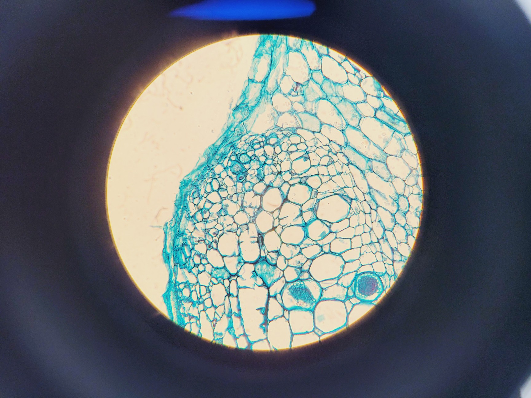 Image of Olympus CHT CH-2 Compound Microscope W/ 0.10/0.25/0.65 Objectives