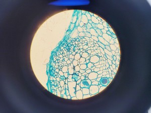 Thumbnail image of Olympus CHT CH-2 Compound Microscope W/ 0.10/0.25/0.65 Objectives