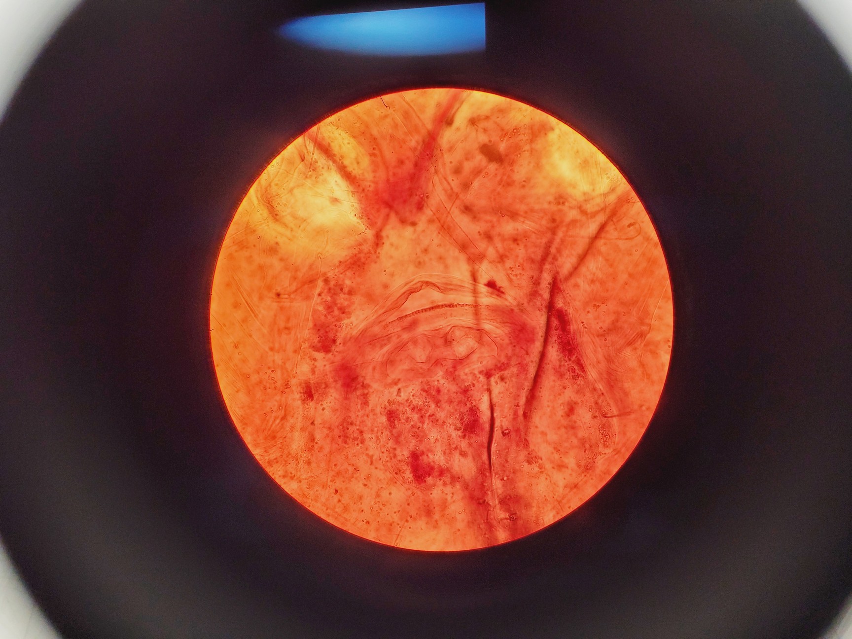 Image of Olympus CHT CH-2 Compound Microscope W/ 0.10/0.25/0.40/0.65 Objectives