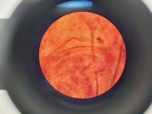 Thumbnail image of Olympus CHT CH-2 Compound Microscope W/ 0.10/0.25/0.40/0.65 Objectives