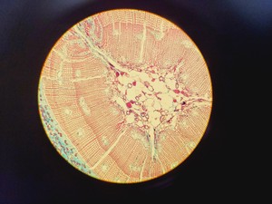 Thumbnail image of Olympus BH-2 Compound Microscope W/ 0.25,0.30,0.45,0.65,0.70&1.25oil Objectives