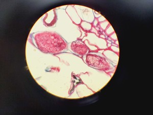 Thumbnail image of Olympus BH-2 Compound Microscope W/ 0.25,0.30,0.45,0.65,0.70&1.25oil Objectives