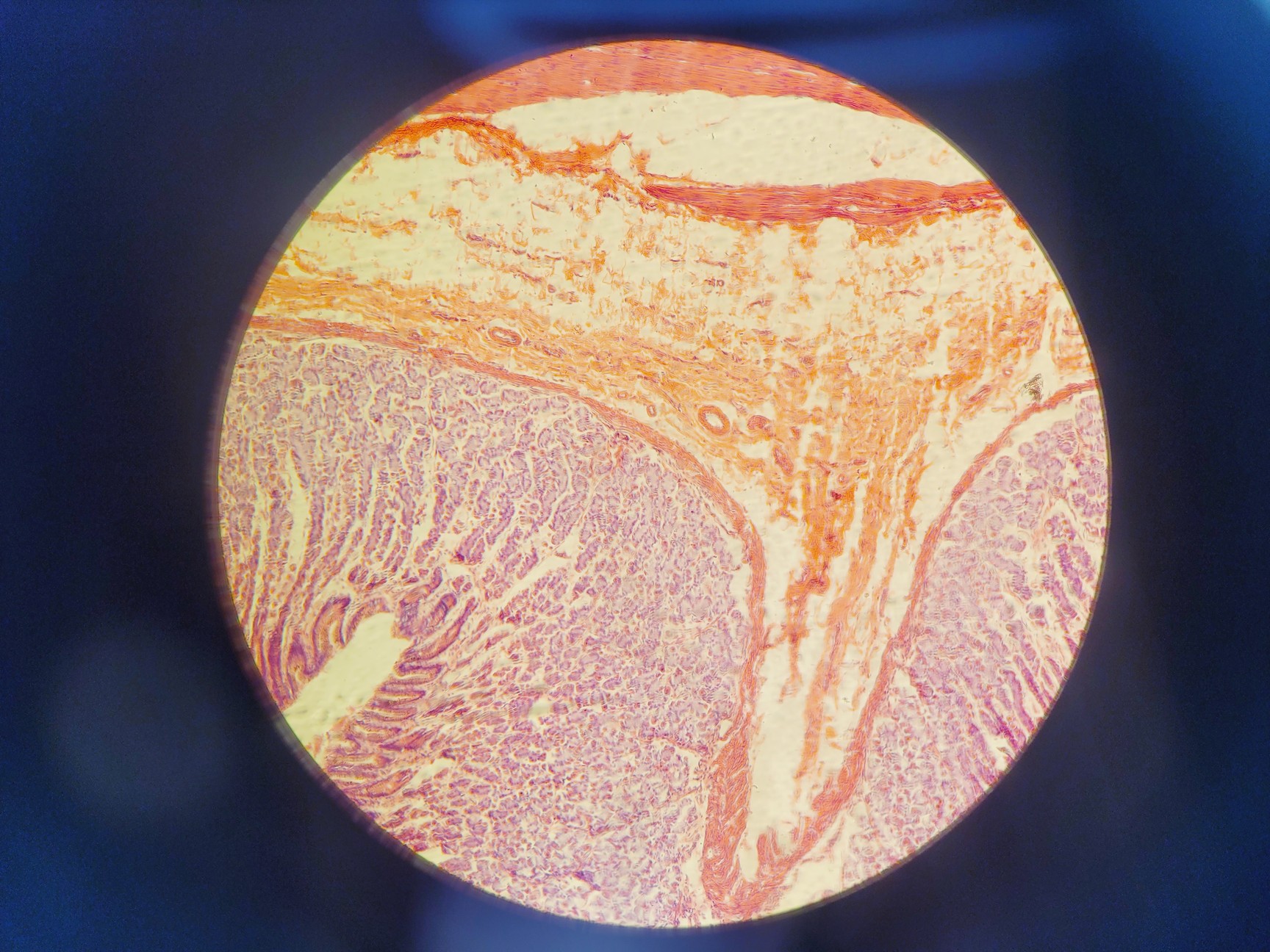 Image of  Carl Zeiss Axio Scope.A1 Microscope w/ AxioCam ICc 5, CoolLED & PC