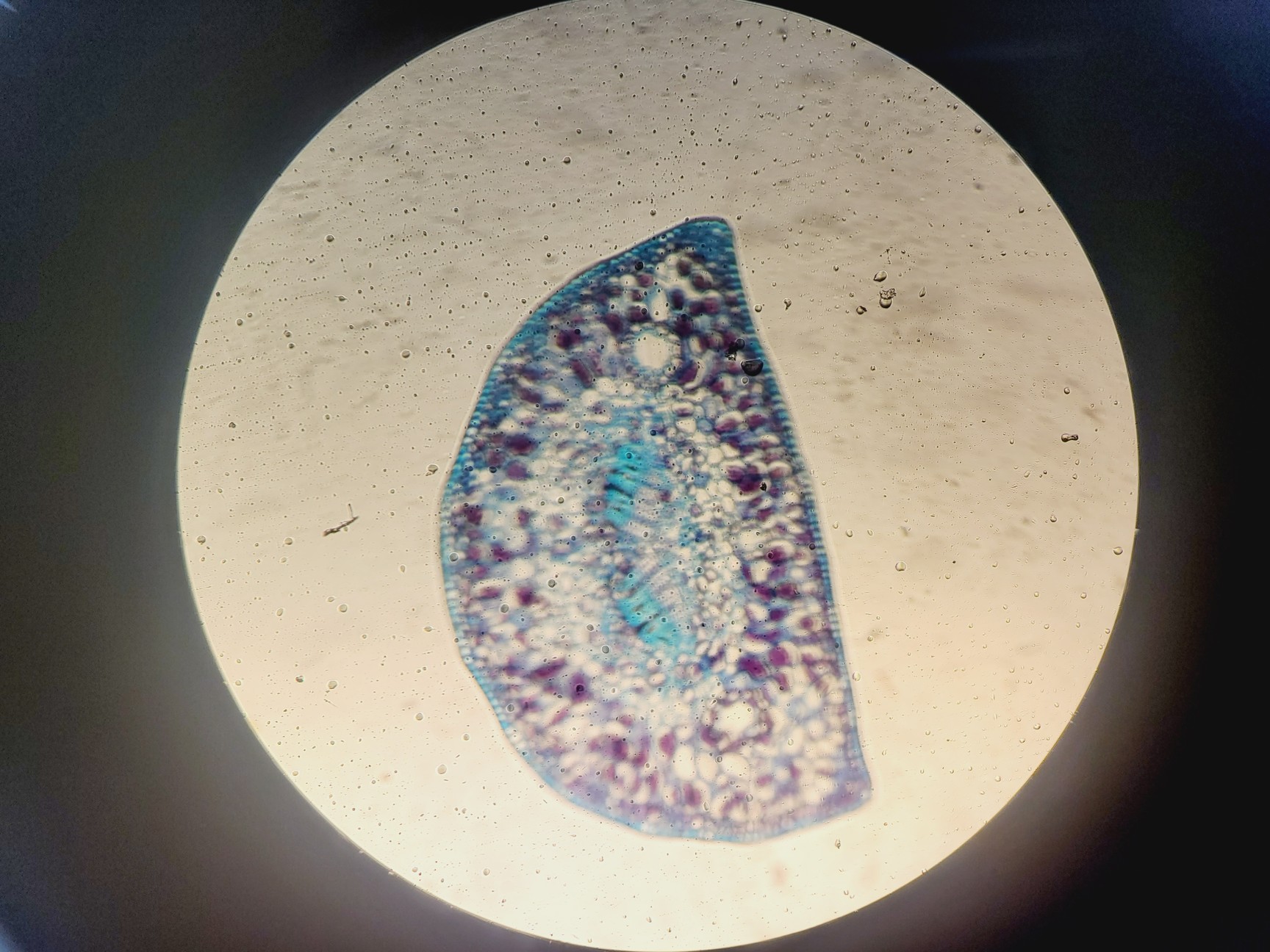Image of  Carl Zeiss Axio Scope.A1 Microscope w/ AxioCam ICc 5, CoolLED & PC
